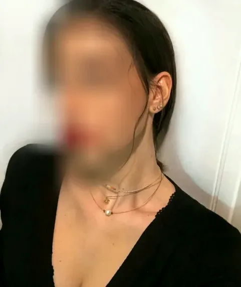 Esther, 25